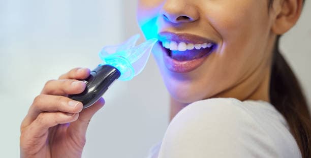 zoom whitening