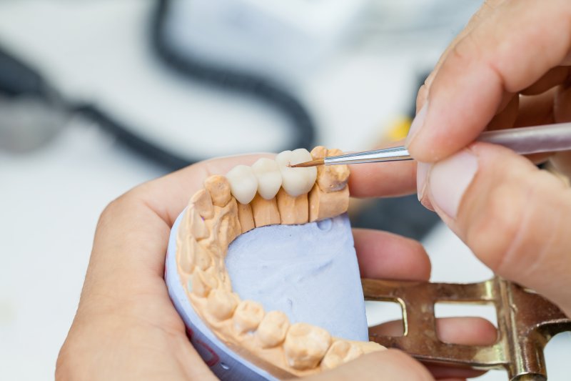 Partial Dentures